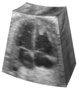 b. Result volume processed by median filter.