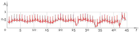 Fig. 1. Original ECG.