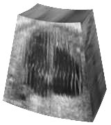4D input voxel image