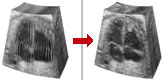 4D ultrasound volume image processing - animation building