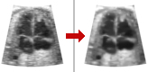 Diffusion filter - speckle noise reduction