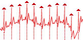 Article 13. ECG processing - R-peaks detection.