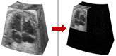 3D wavelet compression of ultrasound volume images